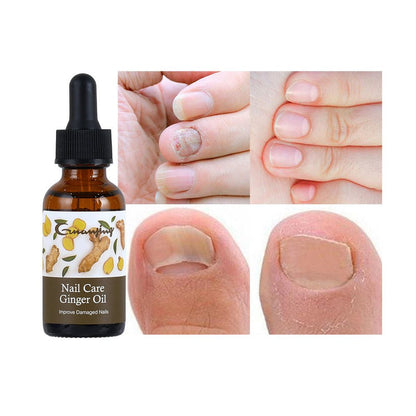 Guanjing - Nail Care Ginger Oil 30ml